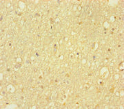 Immunohistochemistry of paraffin-embedded human brain tissue using CSB-PA010241HA01HU at dilution of 1:100