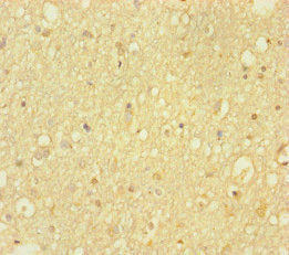 Immunohistochemistry of paraffin-embedded human brain tissue using CSB-PA010241HA01HU at dilution of 1:100