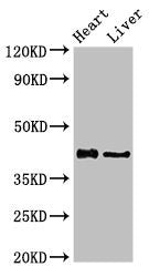Western Blot Positive WB detected in: Rat heart tissue, Rat liver tissue All lanes: HDAC8 antibody at 2.5ug/ml Secondary Goat polyclonal to rabbit IgG at 1/50000 dilution Predicted band size: 42, 30, 18, 32, 29, 16, 17 kDa Observed band size: 42 kDa