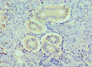 Immunohistochemistry of paraffin-embedded human pancreatic tissue using CSB-PA010244ESR1HU at dilution of 1:100