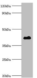 Western blot Western blot All lanes: Histone deacetylase 8 antibody at 2ug/ml + Hela whole cell lysate Secondary Goat polyclonal to rabbit IgG at 1/10000 dilution Predicted band size: 42, 30, 18, 32, 29, 16, 17 kDa Observed band size: 42 kDa