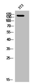 Western Blot analysis of 3T3 cells using Phospho-Ron (S1394) Polyclonal Antibody
