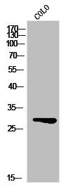 Western Blot analysis of CoLo cells using Msx-2 Polyclonal Antibody