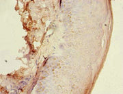 Immunohistochemistry of paraffin-embedded human skin tissue using CSB-PA010285LA01HU at dilution of 1:100
