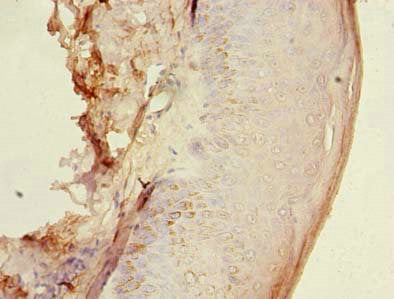Immunohistochemistry of paraffin-embedded human skin tissue using CSB-PA010285LA01HU at dilution of 1:100