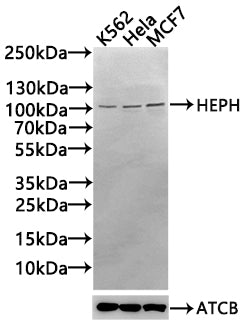 Western Blot Positive WB detected in: K562 whole cell lysate(30µg), Hela whole cell lysate(30µg), MCF7 whole cell lysate(30µg) All lanes: HEPH antibody at 1:1000 Secondary Goat polyclonal to rabbit IgG at 1/20000 dilution Predicted band size: 131,...