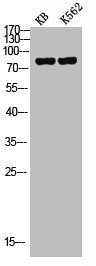Western Blot analysis of KB K562 cells using c-Myb Polyclonal Antibody