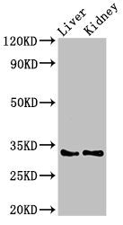 Western Blot Positive WB detected in: Rat liver tissue, Mouse kidney tissue All lanes: HEXIM2 antibody at 3µg/ml Secondary Goat polyclonal to rabbit IgG at 1/50000 dilution Predicted band size: 33 kDa Observed band size: 33 kDa