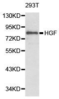 Western blot analysis of extracts of 293T cell line, using HGF antibody.