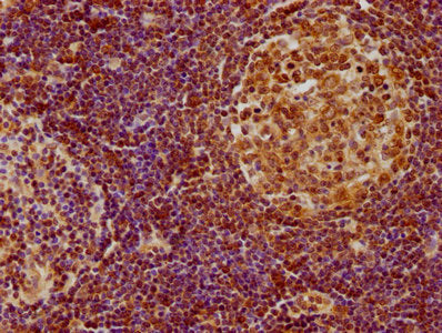 IHC image of CSB-PA010335OA01HU diluted at 1:100 and staining in paraffin-embedded human lymph node tissue performed on a Leica BondTM system. After dewaxing and hydration, antigen retrieval was mediated by high pressure in a citrate buffer (pH 6....