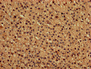 IHC image of CSB-PA01034A0Rb diluted at 1:150 and staining in paraffin-embedded human adrenal gland tissue performed on a Leica BondTM system. After dewaxing and hydration, antigen retrieval was mediated by high pressure in a citrate buffer (pH 6....