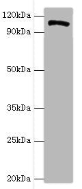 Western blot All lanes: HIP1 antibody at 4ug/ml + A549 whole cell lysate Secondary Goat polyclonal to rabbit IgG at 1/10000 dilution Predicted band size: 117, 111, 114 kDa Observed band size: 117 kDa