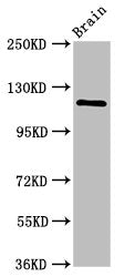 Western Blot Positive WB detected in: Rat brain tissue All lanes: HIP1R antibody at 2.4ug/ml Secondary Goat polyclonal to rabbit IgG at 1/50000 dilution Predicted band size: 120, 71 kDa Observed band size: 120 kDa