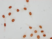 Immunocytochemistry analysis of CSB-PA010376OA21acHU diluted at 1:25 and staining in Hela cells(treated with 30mM sodium butyrate for 4h) performed on a Leica BondTM system. The cells were fixed in 4% formaldehyde, permeabilized using 0.2% Triton...