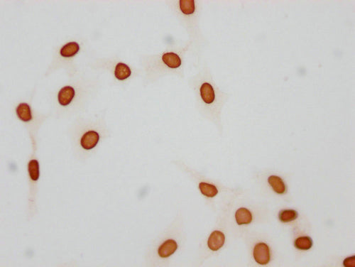 Immunocytochemistry analysis of CSB-PA010376OA21acHU diluted at 1:25 and staining in Hela cells(treated with 30mM sodium butyrate for 4h) performed on a Leica BondTM system. The cells were fixed in 4% formaldehyde, permeabilized using 0.2% Triton...