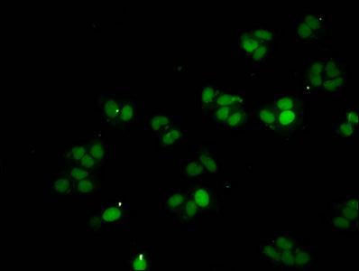 Immunofluorescent analysis of HepG2 cells using CSB-PA010376PA21nme1HU at dilution of 1:100 and Alexa Fluor 488-congugated AffiniPure Goat Anti-Rabbit IgG(H+L)
