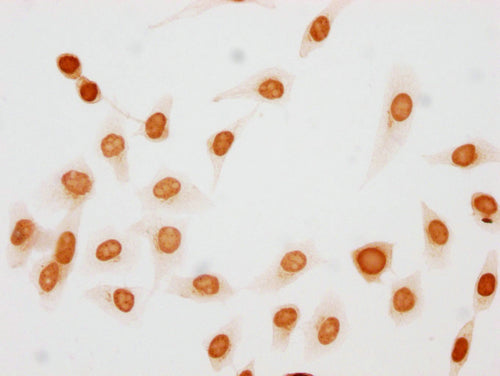 Immunocytochemistry analysis of CSB-PA010377OA10phHU diluted at 1:50 and staining in Hela cells(treated with 50nM Calyculin A for 30min) performed on a Leica BondTM system. The cells were fixed in 4% formaldehyde, permeabilized using 0.2% Triton X...
