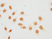 Immunocytochemistry analysis of CSB-PA010377OA137phHU diluted at 1:10 and staining in Hela cells(treated with 50nM Calyculin A for 30min) performed on a Leica BondTM system. The cells were fixed in 4% formaldehyde, permeabilized using 0.2% Triton...