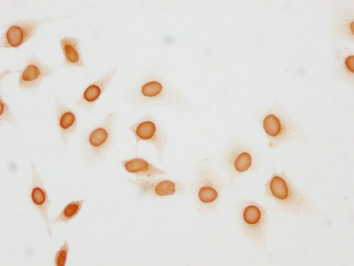 Immunocytochemistry analysis of CSB-PA010377OA137phHU diluted at 1:10 and staining in Hela cells(treated with 50nM Calyculin A for 30min) performed on a Leica BondTM system. The cells were fixed in 4% formaldehyde, permeabilized using 0.2% Triton...