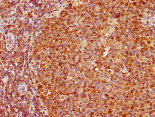 IHC image of CSB-PA010377OA172nphHU diluted at 1:20 and staining in paraffin-embedded human tonsil tissue performed on a Leica BondTM system. After dewaxing and hydration, antigen retrieval was mediated by high pressure in a citrate buffer (pH 6.0...