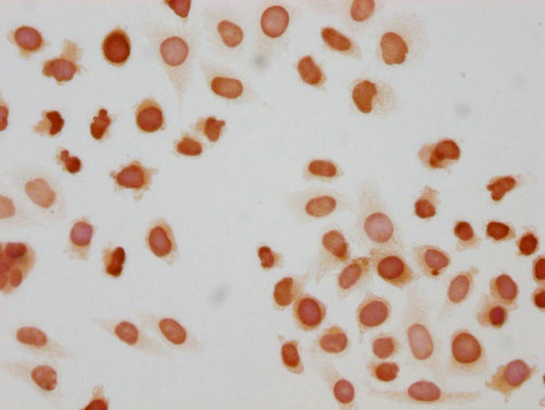 Immunocytochemistry analysis of CSB-PA010377OA172phHU diluted at 1:10 and staining in Hela cells(treated with 50nM Calyculin A for 30min) performed on a Leica BondTM system. The cells were fixed in 4% formaldehyde, permeabilized using 0.2% Triton...