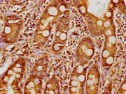 IHC image of CSB-PA010377OA17nphHU diluted at 1:8 and staining in paraffin-embedded human small intestine tissue performed on a Leica BondTM system. After dewaxing and hydration, antigen retrieval was mediated by high pressure in a citrate buffer...