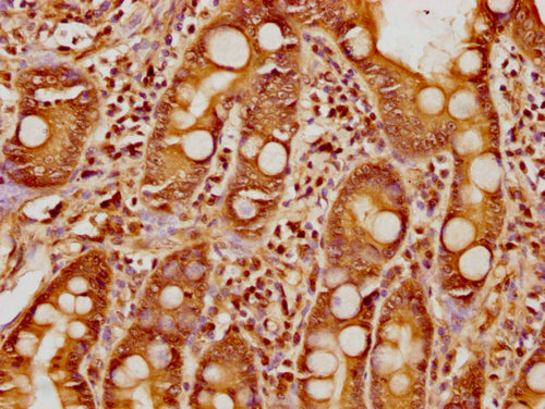 IHC image of CSB-PA010377OA17nphHU diluted at 1:8 and staining in paraffin-embedded human small intestine tissue performed on a Leica BondTM system. After dewaxing and hydration, antigen retrieval was mediated by high pressure in a citrate buffer...