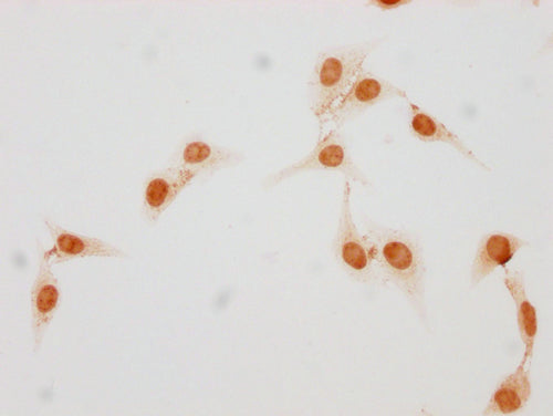 Immunocytochemistry analysis of CSB-PA010377OA17phHU diluted at 1:25 and staining in Hela cells(treated with 50nM Calyculin A for 30min) performed on a Leica BondTM system. The cells were fixed in 4% formaldehyde, permeabilized using 0.2% Triton X...
