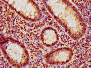 IHC image of CSB-PA010377OA188nphHU diluted at 1:10 and staining in paraffin-embedded human appendix tissue performed on a Leica BondTM system. After dewaxing and hydration, antigen retrieval was mediated by high pressure in a citrate buffer (pH 6...