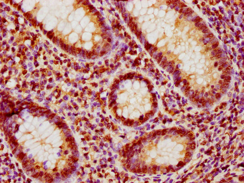 IHC image of CSB-PA010377OA188nphHU diluted at 1:10 and staining in paraffin-embedded human appendix tissue performed on a Leica BondTM system. After dewaxing and hydration, antigen retrieval was mediated by high pressure in a citrate buffer (pH 6...