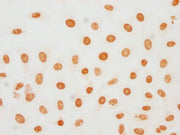 Immunocytochemistry analysis of CSB-PA010377OA188phHU diluted at 1:20 and staining in Hela cells(treated with 50nM Calyculin A for 30min) performed on a Leica BondTM system. The cells were fixed in 4% formaldehyde, permeabilized using 0.2% Triton...