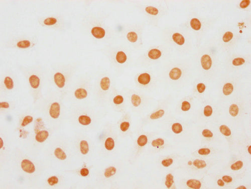 Immunocytochemistry analysis of CSB-PA010377OA188phHU diluted at 1:20 and staining in Hela cells(treated with 50nM Calyculin A for 30min) performed on a Leica BondTM system. The cells were fixed in 4% formaldehyde, permeabilized using 0.2% Triton...