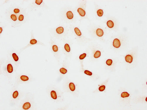 Immunocytochemistry analysis of CSB-PA010377OA48acHU diluted at 1:15 and staining in Hela cells(treated with 30mM sodium butyrate for 4h) performed on a Leica BondTM system. The cells were fixed in 4% formaldehyde, permeabilized using 0.2% Triton...