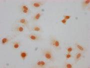 Immunocytochemistry analysis of CSB-PA010377OA66forHU diluted at 1:10 and staining in Hela cells(treated with 30mM sodium butyrate for 4h) performed on a Leica BondTM system. The cells were fixed in 4% formaldehyde, permeabilized using 0.2% Triton...