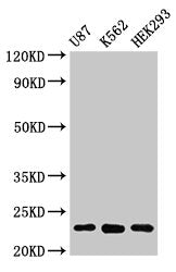 Western Blot Positive WB detected in: U87 whole cell lysate, K562 whole cell lysate, HEK293 whole cell lysate All lanes: HIST1H1B antibody at 1µg/ml Secondary Goat polyclonal to rabbit IgG at 1/50000 dilution Predicted band size: 23 kDa Observed b...