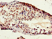 Secondary antibody only control: uses 1% BSA instead of primary antibody