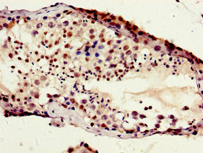 Secondary antibody only control: uses 1% BSA instead of primary antibody