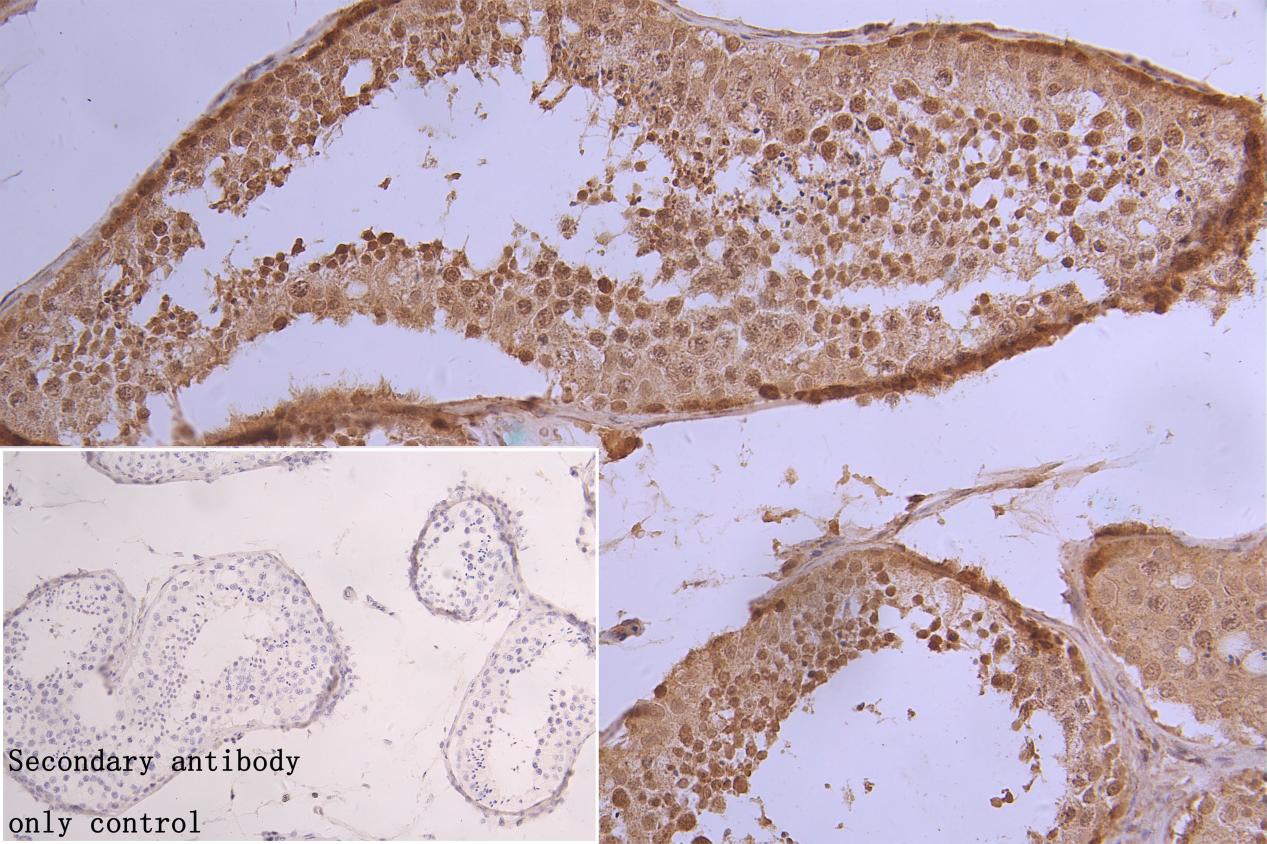 IHC image of CSB-PA010377PA154phHU diluted at 1:50 and staining in paraffin-embedded human testis tissue performed on a Leica BondTM system. After dewaxing and hydration, antigen retrieval was mediated by high pressure in a citrate buffer (pH 6.0)...