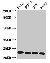 Western Blot Positive WB detected in: Hela whole cell lysate, MCF-7 whole cell lysate, U87 whole cell lysate, K562 whole cell lysate All lanes: HIST1H1B antibody at 1µg/ml Secondary Goat polyclonal to rabbit IgG at 1/50000 dilution Predicted band...