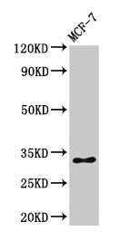 Western Blot Positive WB detected in: MCF-7 whole cell lysate All lanes: HIST1H1B antibody at 1µg/ml Secondary Goat polyclonal to rabbit IgG at 1/50000 dilution Predicted band size: 23 kDa Observed band size: 32 kDa