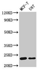 Western Blot Positive WB detected in: MCF-7 whole cell lysate, U87 whole cell lysate All lanes: HIST1H1B antibody at 1.5µg/ml Secondary Goat polyclonal to rabbit IgG at 1/50000 dilution Predicted band size: 23 kDa Observed band size: 23 kDa