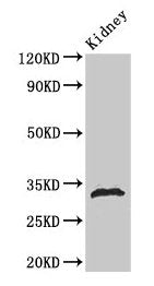 Western Blot Positive WB detected in: Rat kidney tissue All lanes: HIST1H1B antibody at 1µg/ml Secondary Goat polyclonal to rabbit IgG at 1/50000 dilution Predicted band size: 23 kDa Observed band size: 32 kDa