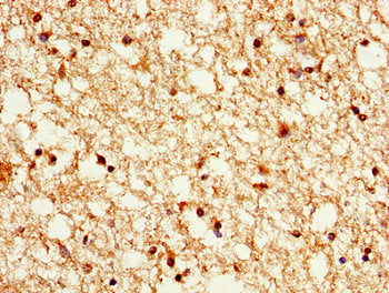 Immunohistochemistry of paraffin-embedded human brain tissue using CSB-PA010377PA48nacHU at dilution of 1:100