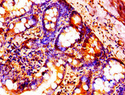 Immunohistochemistry of paraffin-embedded human small intestine tissue using CSB-PA010377PA66nforHU at dilution of 1:100