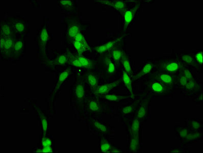 Immunofluorescence staining of Hela cells with CSB-PA010378OA105me1HU at 1:2.5, counter-stained with DAPI. The cells were fixed in 4% formaldehyde, permeabilized using 0.2% Triton X-100 and blocked in 10% normal Goat Serum. The cells were then inc...