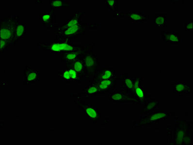 Immunofluorescence staining of Hela cells with CSB-PA010378OA105nme1HU at 1:2.5, counter-stained with DAPI. The cells were fixed in 4% formaldehyde, permeabilized using 0.2% Triton X-100 and blocked in 10% normal Goat Serum. The cells were then in...