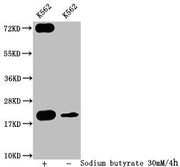 Western Blot Detected samples: K562 whole cell lysate; Untreated (-) or treated (+) with 30mM sodium butyrate for 4h All lanes: HIST1H1C antibody at 1:400 Secondary Goat polyclonal to rabbit IgG at 1/50000 dilution Predicted band size: 22 kDa Obse...