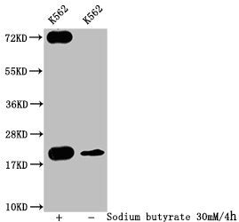 Western Blot Detected samples: K562 whole cell lysate; Untreated (-) or treated (+) with 30mM sodium butyrate for 4h All lanes: HIST1H1C antibody at 1:400 Secondary Goat polyclonal to rabbit IgG at 1/50000 dilution Predicted band size: 22 kDa Obse...
