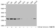 Western Blot Detected samples: Hela whole cell lysate, 293 whole cell lysate, A549 whole cell lysate, HepG2 whole cell lysate; Untreated (-) or treated (+) with 30mM sodium butyrate for 4h All lanes: HIST1H1C antibody at 3.5µg/ml Secondary Goat po...