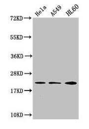 Western Blot Positive WB detected in: Hela whole cell lysate, A549 whole cell lysate, HL60 whole cell lysate All lanes: HIST1H1C antibody at 1:500 Secondary Goat polyclonal to rabbit IgG at 1/40000 dilution Predicted band size: 22 kDa Observed ban...
